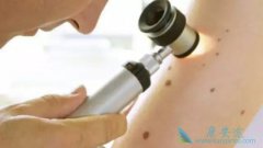 ����ҽ�Ƹ������ɫ����Ϊ�θ����������֮��