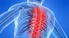 ����ҽ�Ƹ�������������쳣�ۺ�֢�����ھ�֢