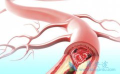 ����ҽ�Ƹ�������Ĳ�����ͻȻ�����ԭ������Щ��