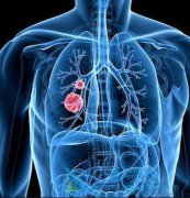 ����ҽ�Ʒΰ���ת��֢״���ֺ��ܻ��ã�