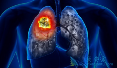 (ERLOTINIB)ΪEGFRͻNSCLCƴʲôı