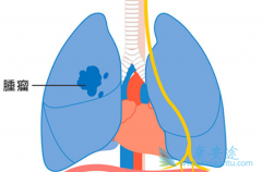 /뼪һEGFRͻNSCLC