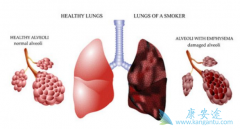 ΰ߷ðϣ(OSIMERTINIB)Ӱ컳кͲ