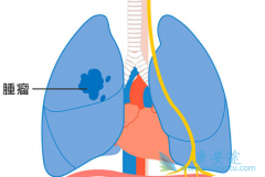 ϣ(Osimertinib)־ҹΰʽȫ̰ʱ