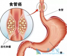 ķ(Pembrolizumab)θʳܽ԰֢Чô