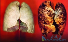 (Mekinist)ڷΰЧΪ64%