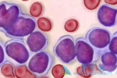 쳣ۺ֢Ӧη׵(lenalidomide)