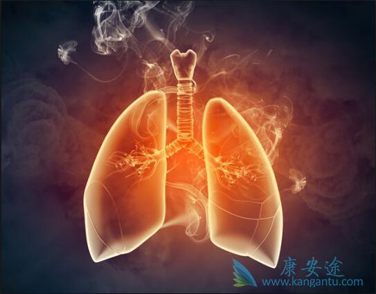 �ΰ����󸴷�