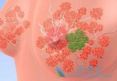 ������������ҩORAPANI���������͵����ٰ�������Ч��