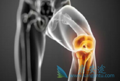 �ΰ���ת����ô���ƣ��õ�ŵ��������������᣿