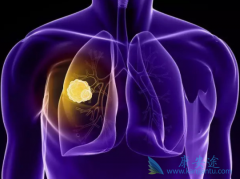 ����Щ���������ڷΰ���ת�ƻ���Ԥ����ԽϺã�