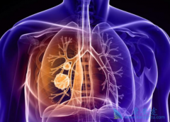 ����ҩ������������ȷ����ͻ��ķ�Сϸ���ΰ�����Ҫ�ֶ�