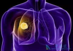 ��ƥ����(ipilimumab)������ɼ���ܸ��Ʒ��۰����ߵ�������