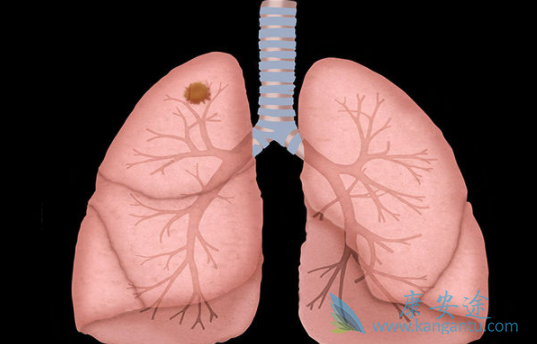 ��Сϸ���ΰ�