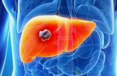 ��Ī«����(Cyramza)���������ڸΰ���