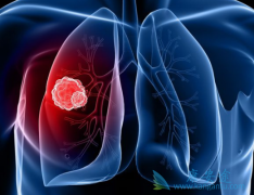 �ΰ���ת�Ʒ������ϰ���ҩ�������ѧԭ��