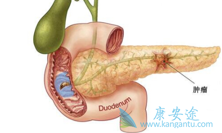 ���ٰ�������