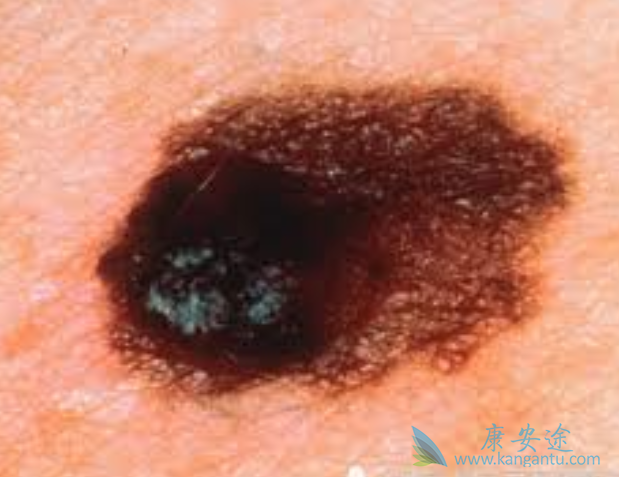 ��ɫ����