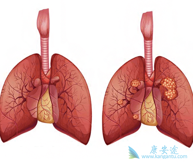 �ΰ�egfr�е�