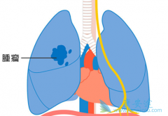 ��������������Ϊ��������Сϸ���ΰ�����Ч��Ѫ�ܰ���ҩ