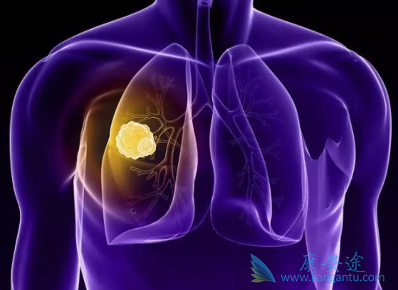 �ΰ�����