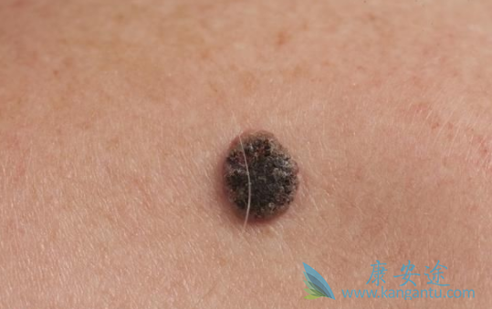 ��ɫ������ʲô