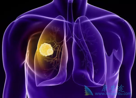 ��Ī«����