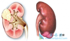 ��Σ����������������������(SUNITINIB)�ܷ�����޲������ʣ�