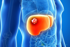 �ΰ����Ʒ�����ôѡ�����������ʺ����ָΰ����ߣ�