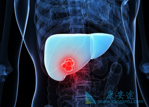 肝癌治疗 肝癌治疗