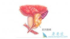 ����ǰ���ٰ�֢״����ͨ������Щ��