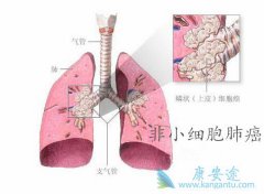 �̵����Ʒ�Сϸ���ΰ���ALK����ҩ������Щ