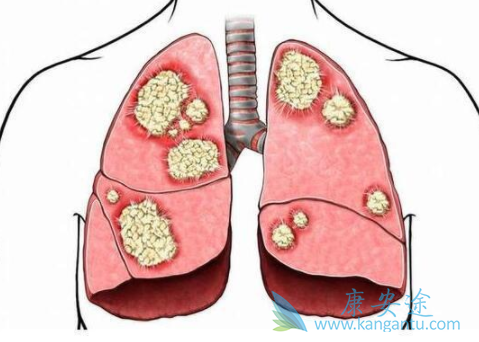 �ΰ�����