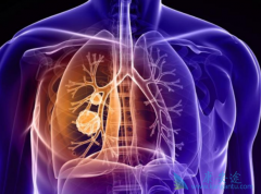 �ΰ������ܻ��ã��ΰ���������Щ֢״�Ƚ����ԣ�