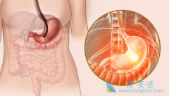 θ���ܻ��ã�����θ������Щ��������ҩ�