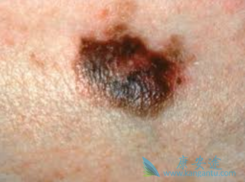 ��ɫ����