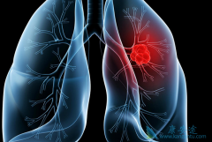 �������(Vizimpro)���ٴ�Ч���ͼ����������ʲô��ͬ��