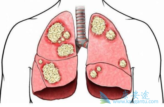 ��Сϸ���ΰ�