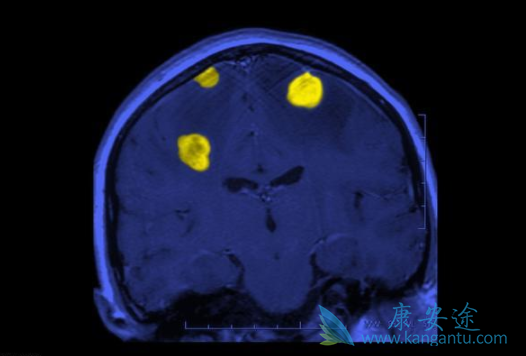 �����Բ�