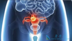 �ѳ�����Ҫ�������ѳ������ƶ೤ʱ����Կ�����Ч��