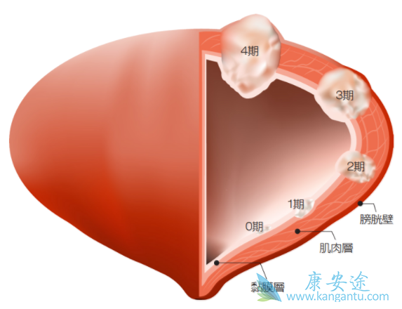 ���װ�����