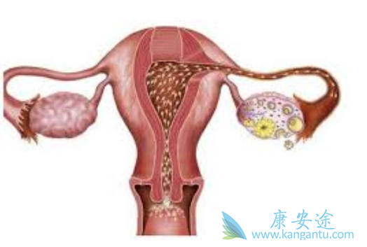 �ѳ�������