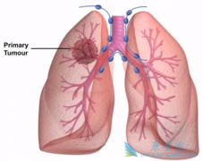 ����ҩ������ǰ���л������Ƿΰ������ƹ淶