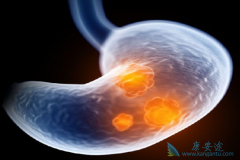 θ����ҩLonsurf��Ϊ���ڻ��ߴ�����õ�������棿