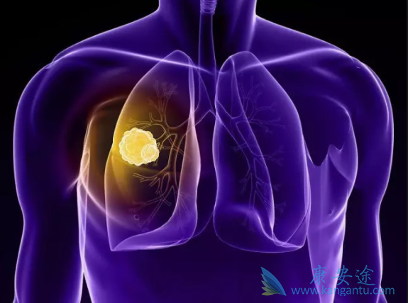 �ΰ�����