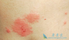 ������Ƥ����ô���ƲŸ��ӹ淶��Ч��