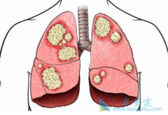 ���ڷΰ������Ѷȴ�����Ϊ�����ѳ����˶ദת��