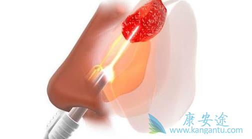 ���ʰ������