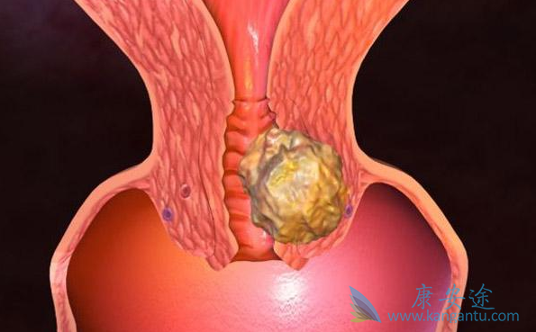 ���ƹ�����