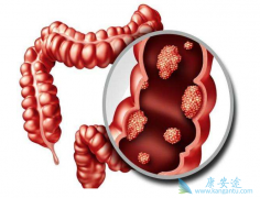 ������������������֢״��������Щ��